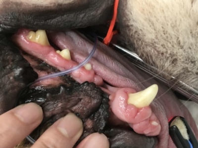 腫れた歯茎